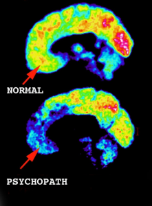 Psychopathic Brain